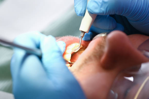 Best Emergency Dental Surgery in Glenwood, MN