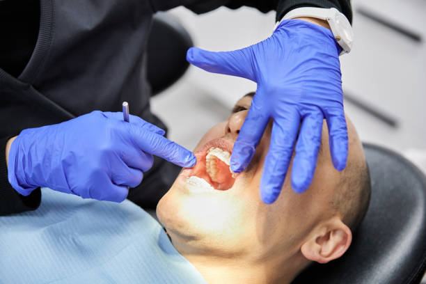 Best Walk-In Emergency Dentist in Glenwood, MN