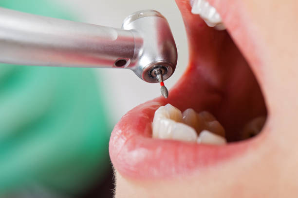 Best Emergency Broken Tooth Repair in Glenwood, MN